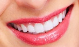 Top 10 Cách làm trắng răng đơn giản tại nhà