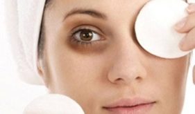 Top 6 Cách trị thâm quầng mắt đơn giản, hiệu quả và tiết kiệm