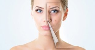 Top 8 Sai lầm khi dưỡng da khiến da mãi không thể đẹp lên