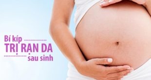 Top 9 Bí quyết xóa rạn da khi mang thai bằng chanh