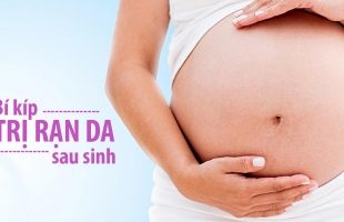Top 9 Bí quyết xóa rạn da khi mang thai bằng chanh